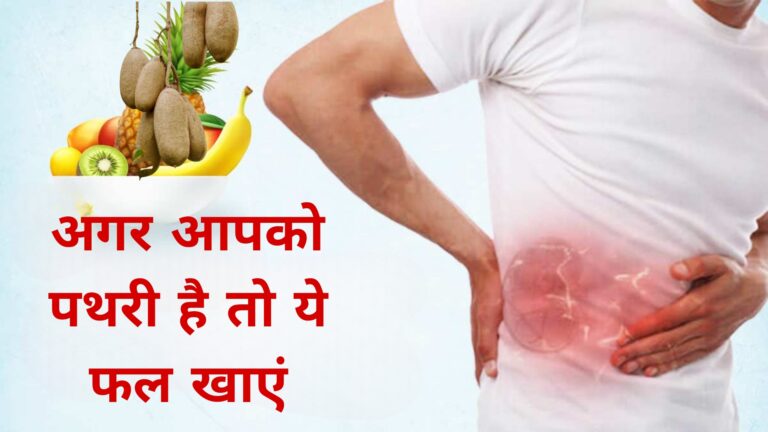 अगर आपको पथरी है तो यह फल खाएं